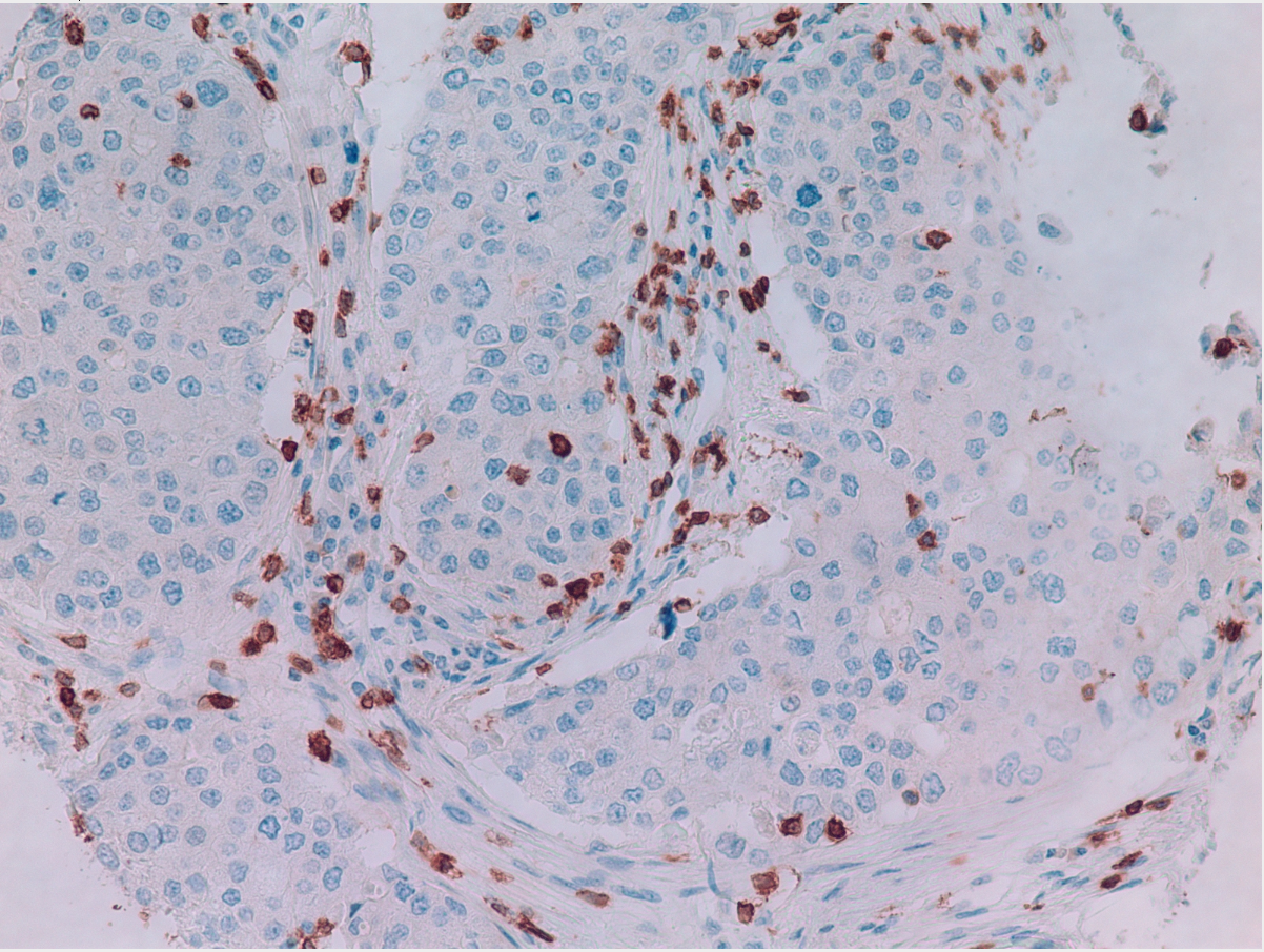Unstained IHC slide